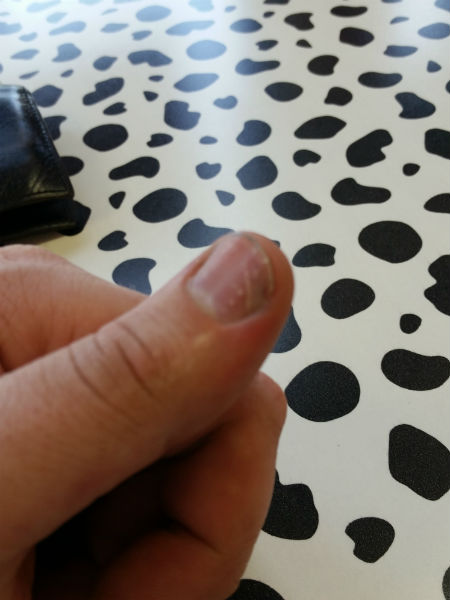 Hurt Thumb